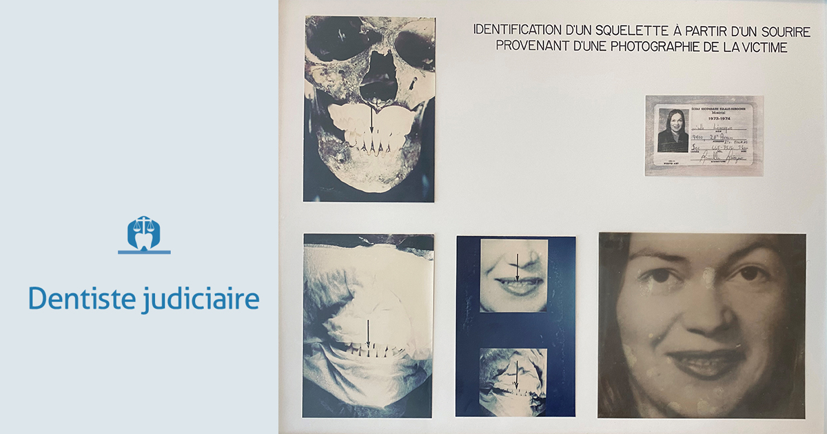 Dentiste judiciaire