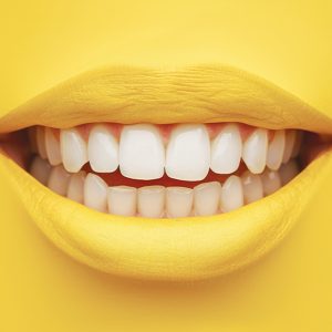 Dents